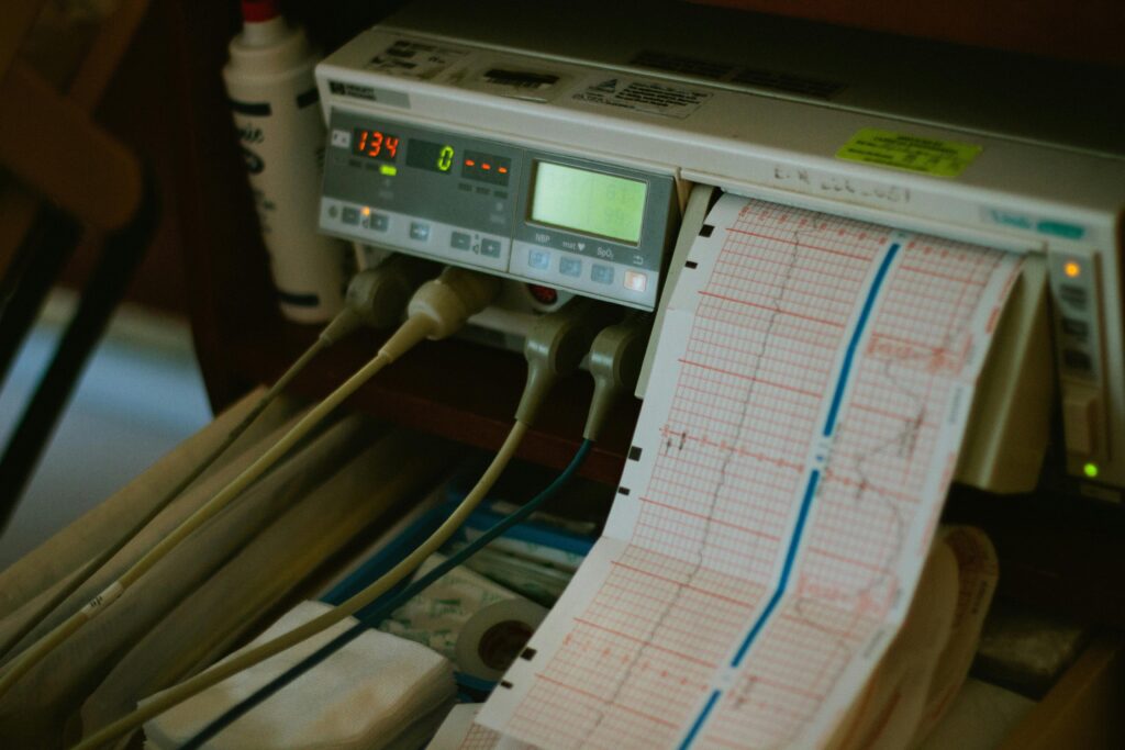 pexels photo 263194 263194 Close-up of an ECG machine displaying heart rate results in a hospital setting.